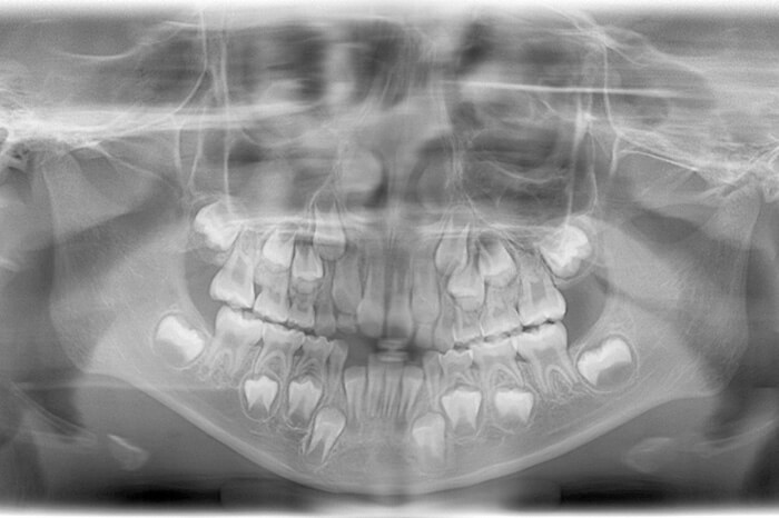 成長に合わせた予防プログラム